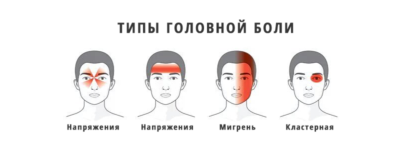 Головные боли о чем расскажет локация и характер боли